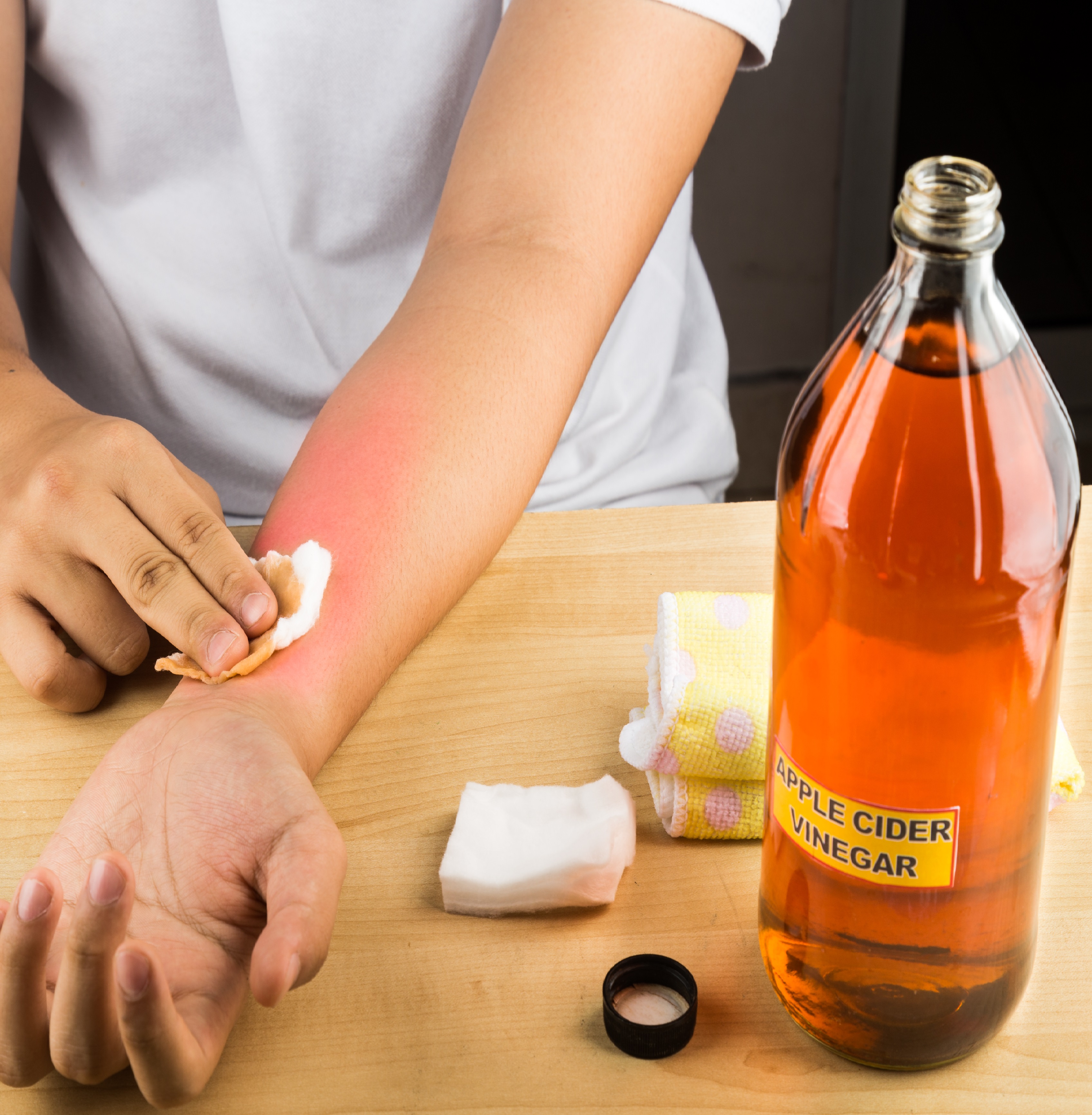 Apple cider vinegar effective natural remedy for skin itch, fung