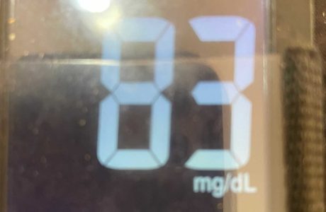 הערכים של הסוכר ירדו בתלילות מ 170 ל 90, 87, והבוקר 83!!!