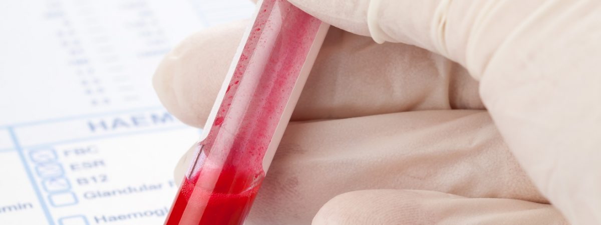 Hand with latex glove holding blood sample vial in front of blood test form