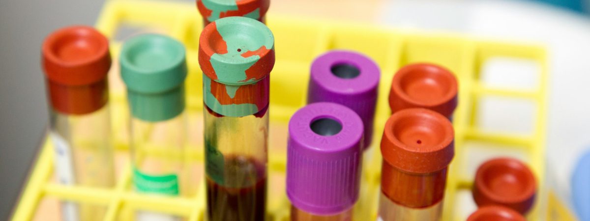 בדיקות דם - המדריך