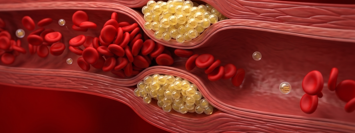 triglyceride